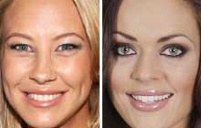 Sandy Meyer Wölden und Kate Hall zeigen ihren After-Baby-Body