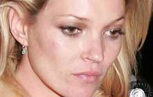 Kate Moss' krasses Statement