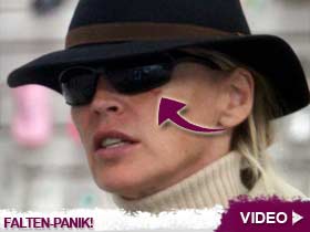 Video – Sharon Stones mysteriöser blauer Fleck